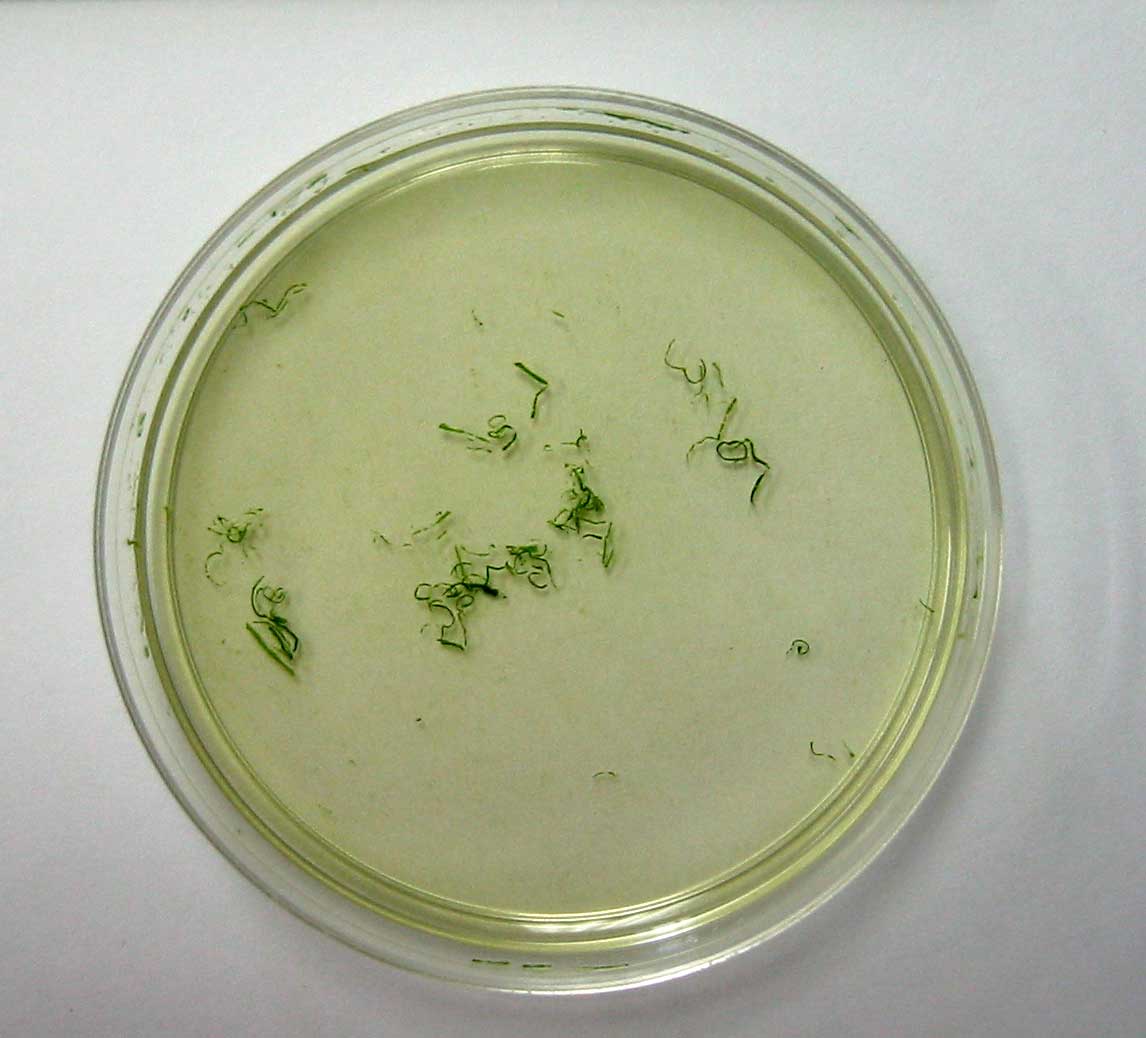 PostDigestion
